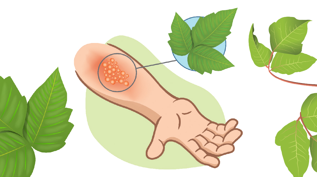 If you're itching to get rid of poison ivy in your yard, wait